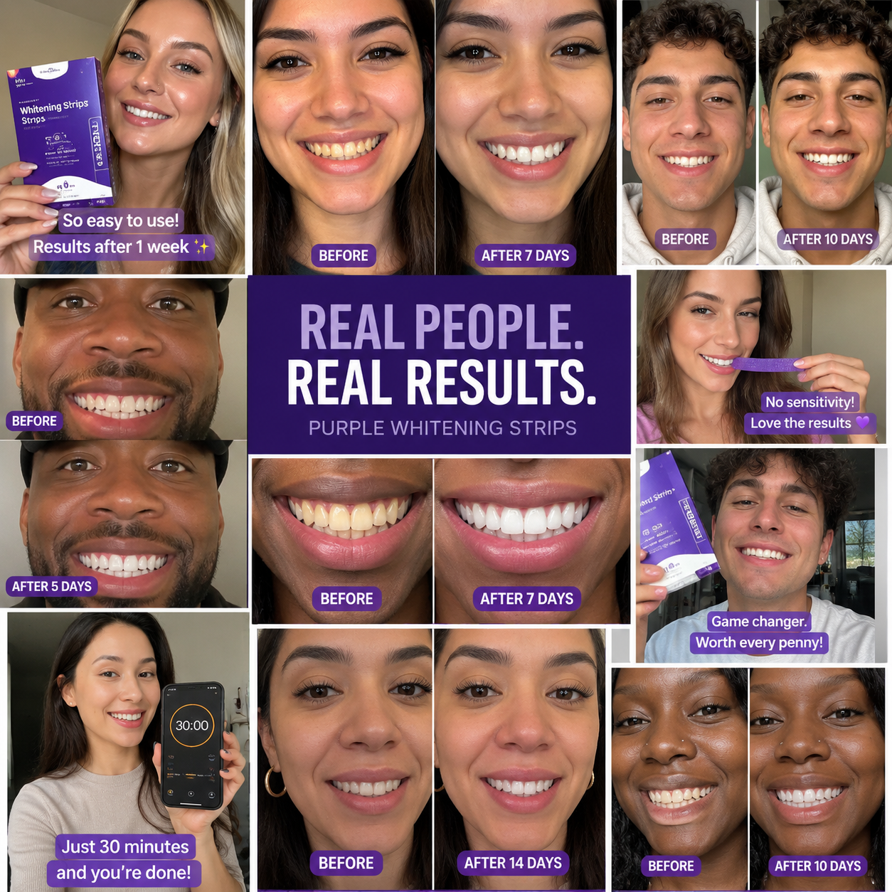 Purple Whitening Strips